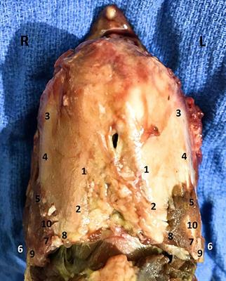 Ex-vivo Mechanical Testing of Novel Laryngeal Clamps Used for Laryngeal Advancement Constructs